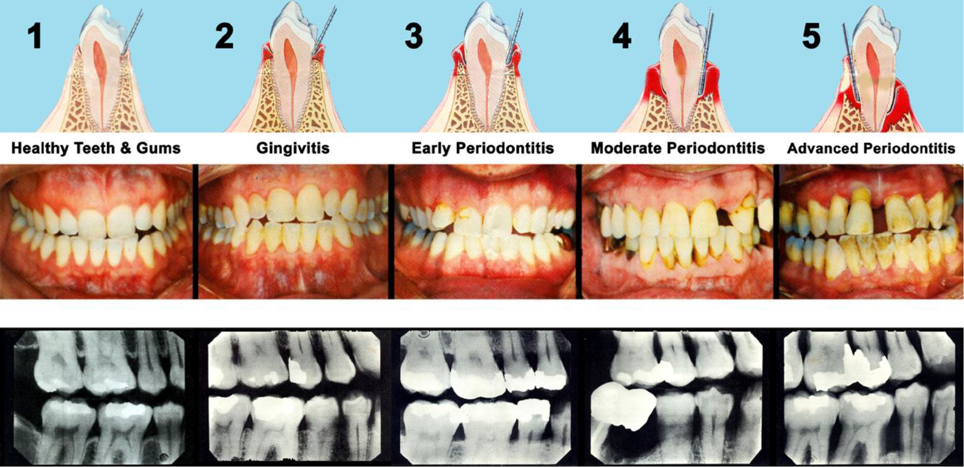 Periodontal Treatments graphic