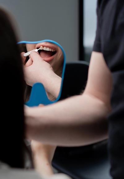 dental veneers Rio Rancho, NM