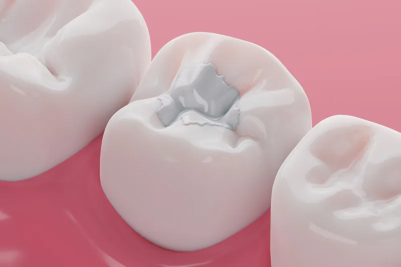 restorative dentistry Rio Rancho, NM